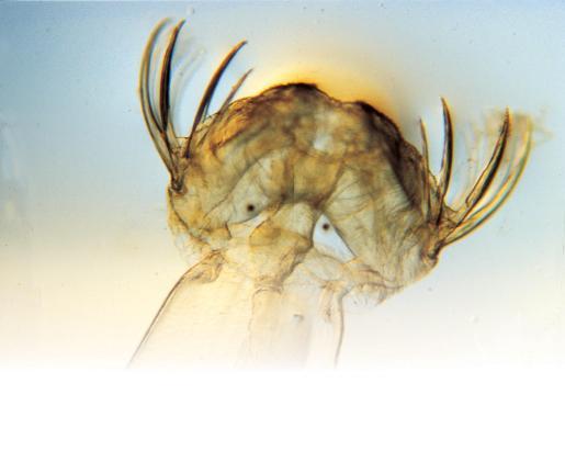 턱 주변에 강한 털을 가지고 있는 화살벌레 의 사진