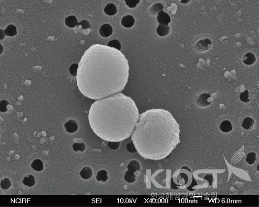 고균 NA1의 전자현미경 사진 의 사진