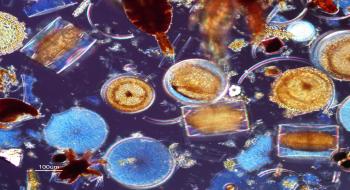 동식물플랑크톤 현미경 사진 의 사진