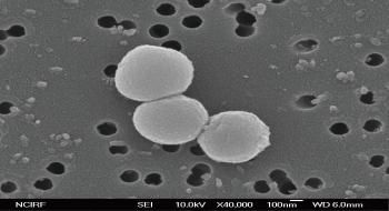 고균 NA1의 전자현미경 사진 의 사진